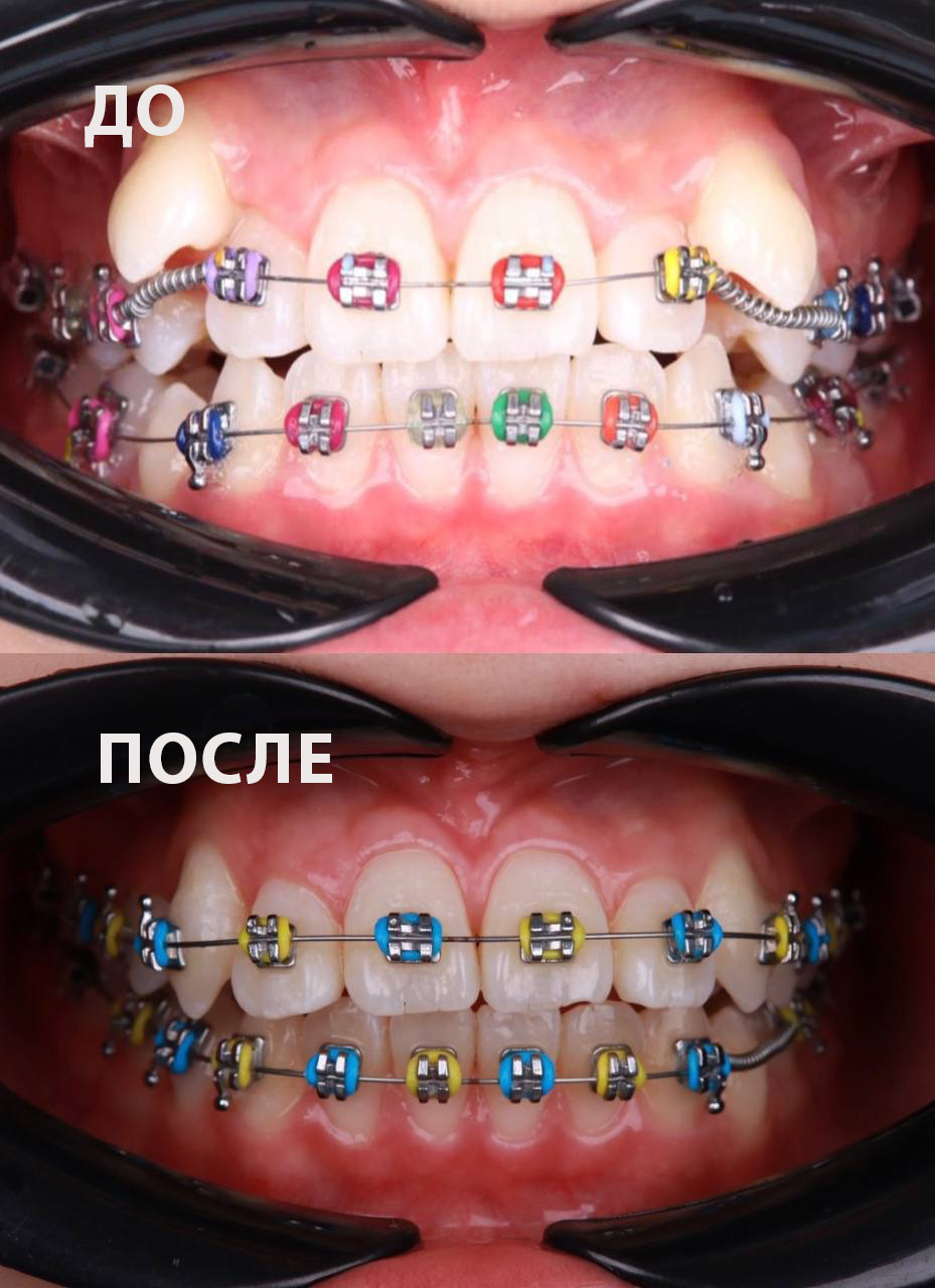 Ortodontics